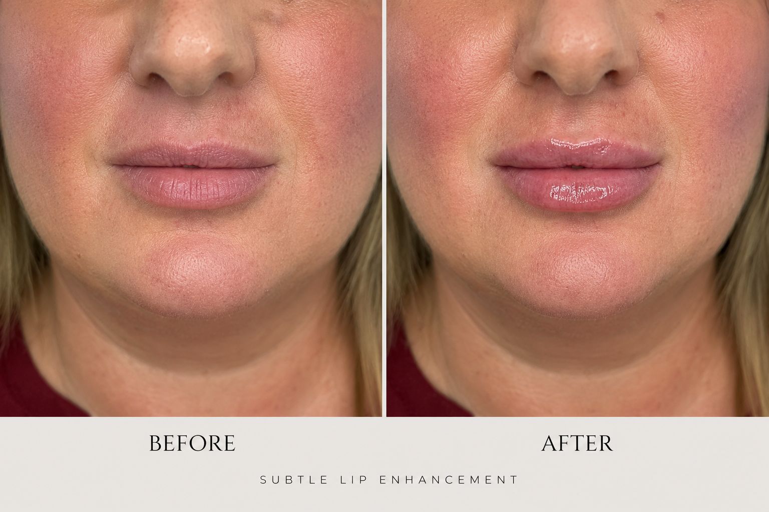 Before and after comparison